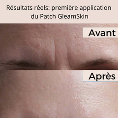 Patchs Visage Anti-Rides Réutilisables
