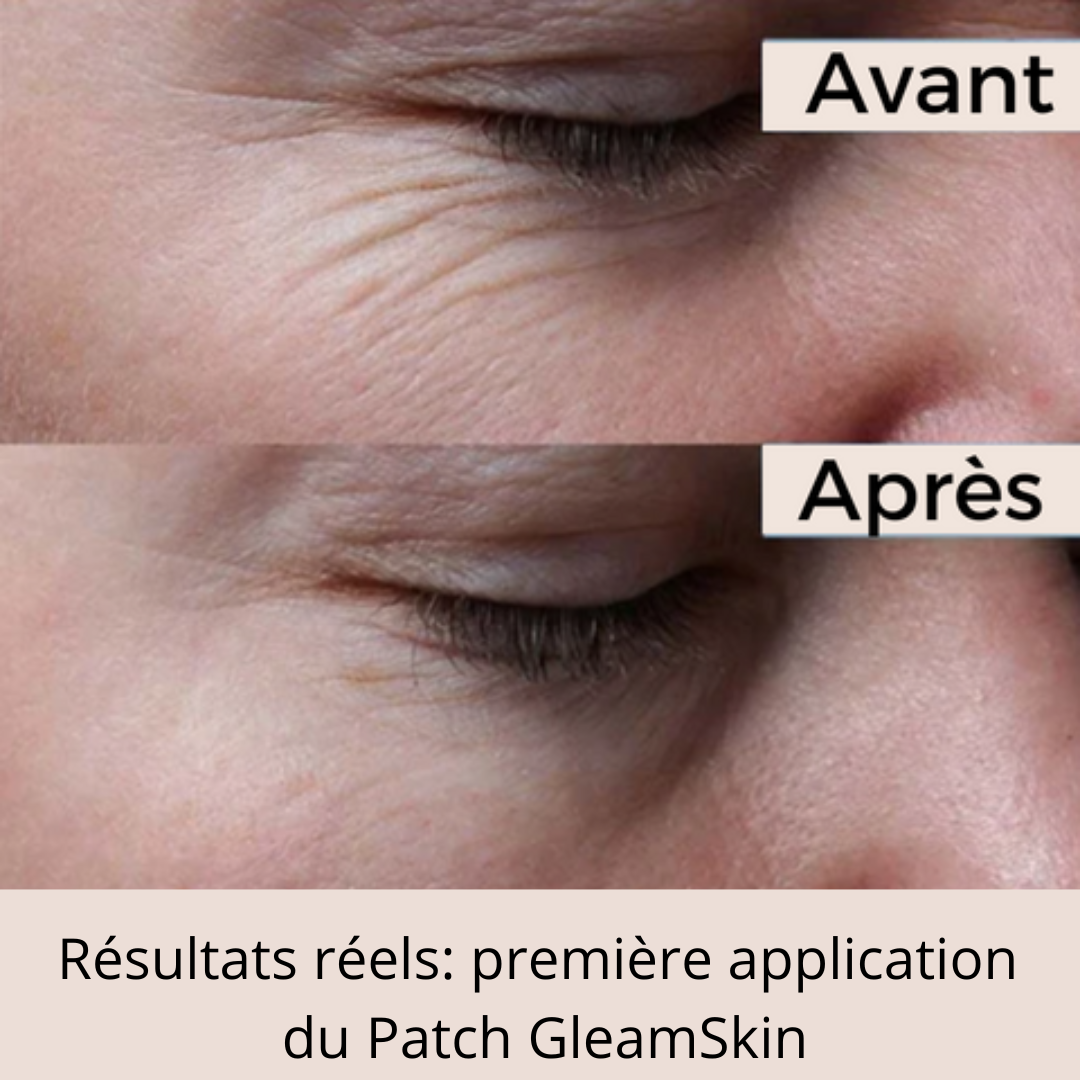 GleamSkin