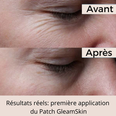 Patchs Visage Anti-Rides Réutilisables